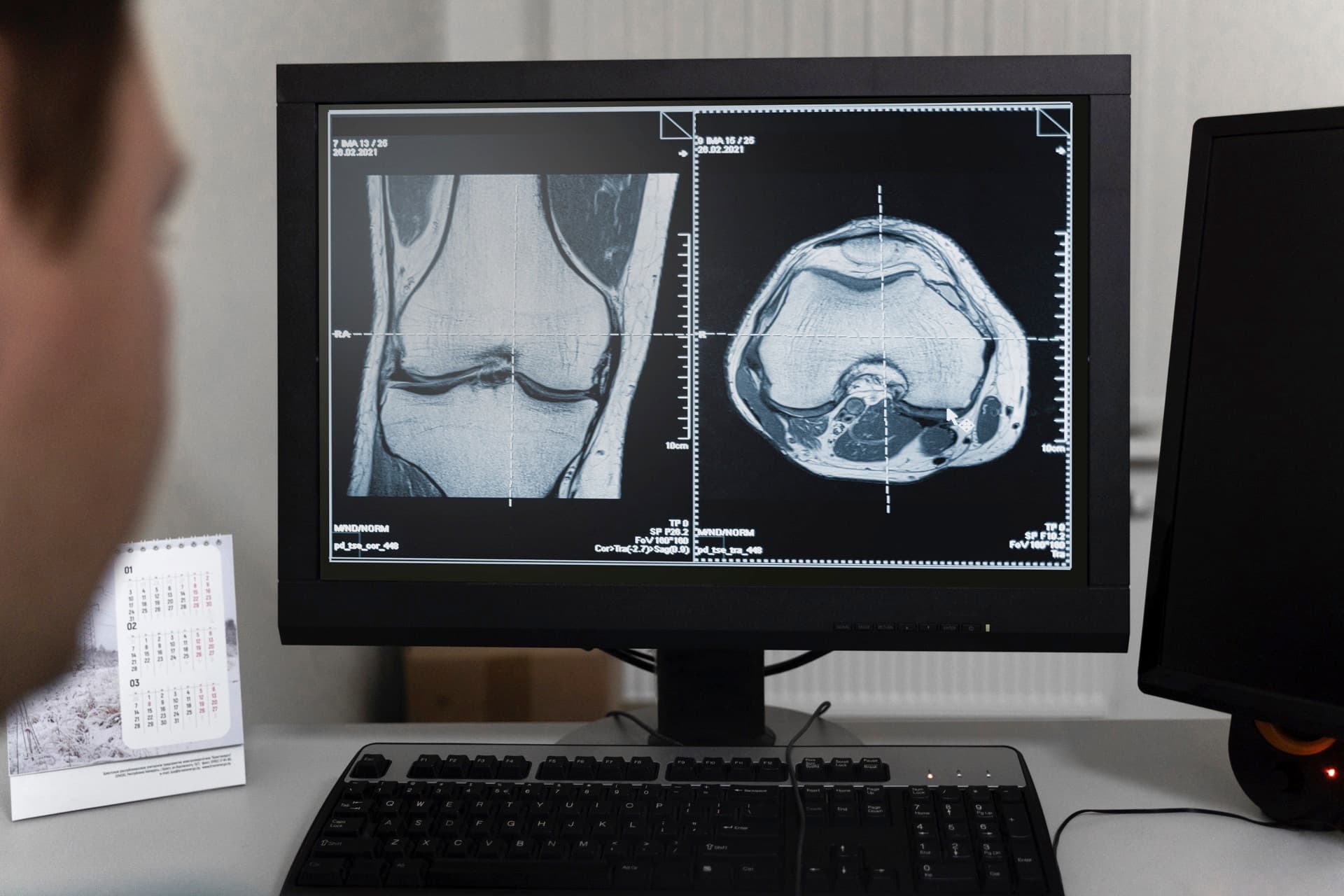 Clinician reviewing cross-sectional bone imaging on a monitor